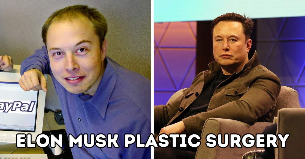 elon musk plastic surgery