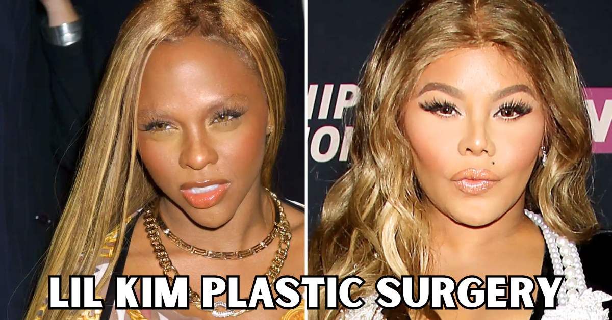 lil kim plastic surgery