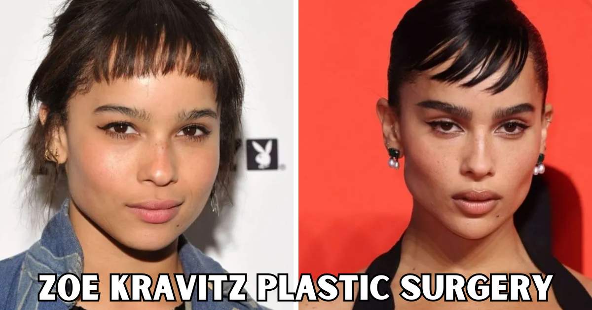 zoe kravitz plastic surgery