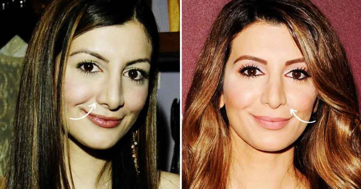 nasim pedrad plastic surgery 