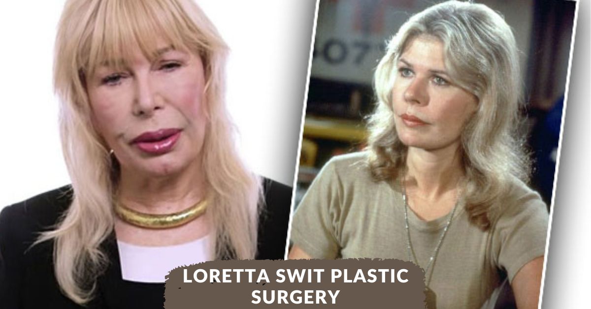 Loretta Swit Plastic Surgery