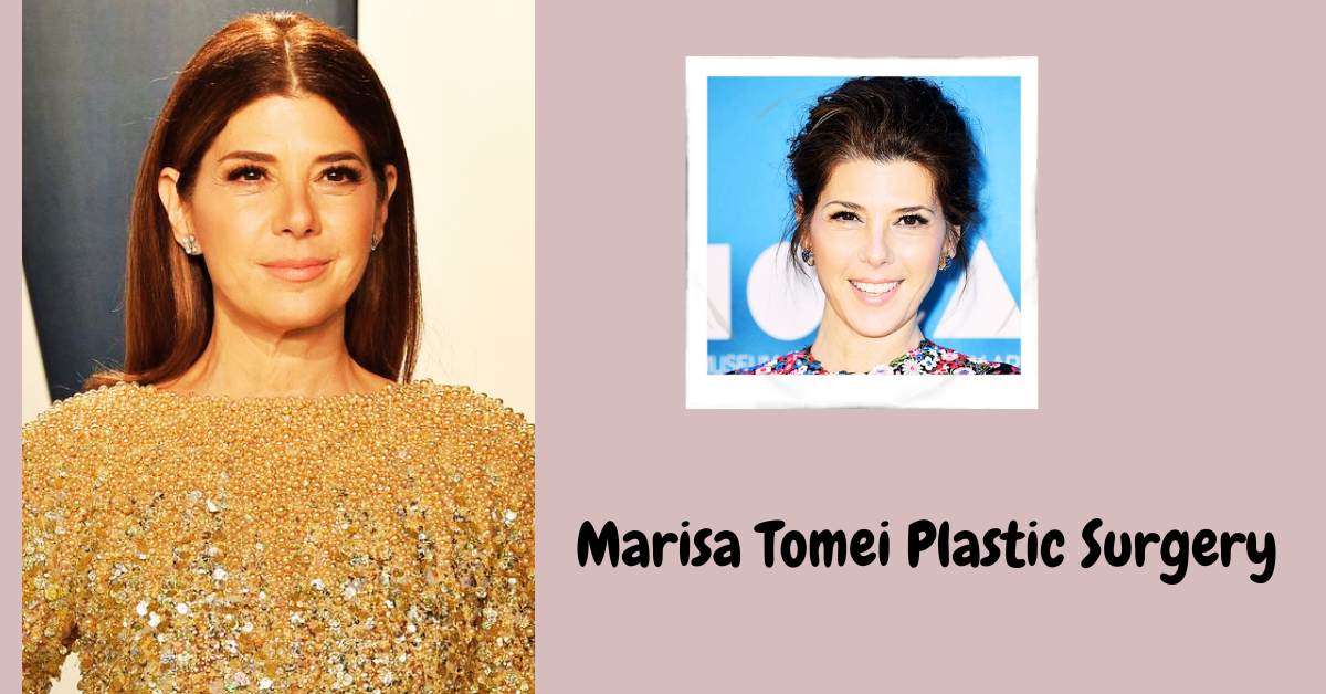 Marisa Tomei Plastic Surgery