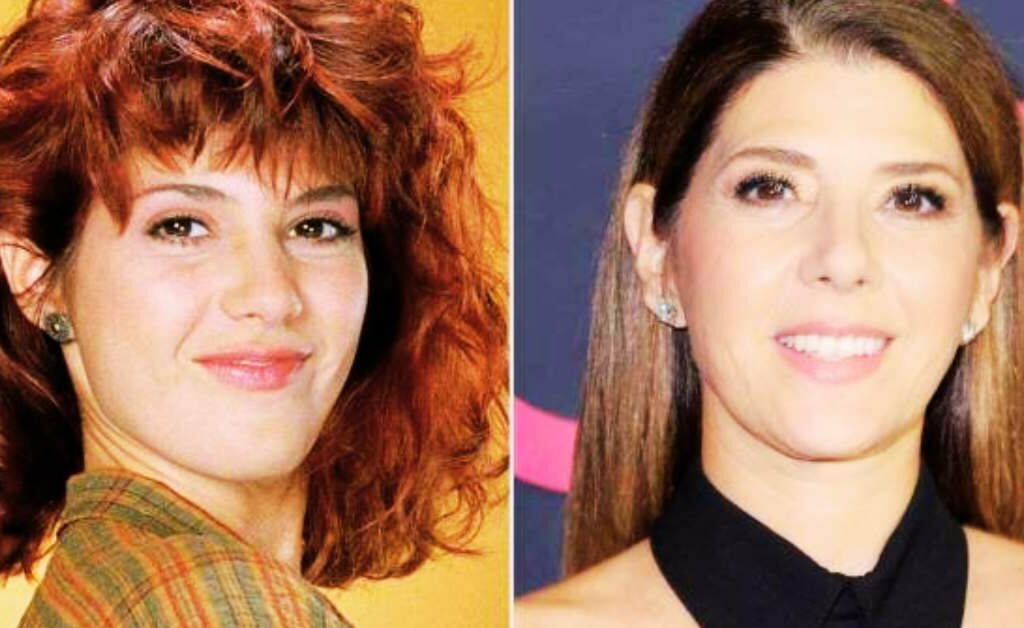 Marisa Tomei Plastic Surgery