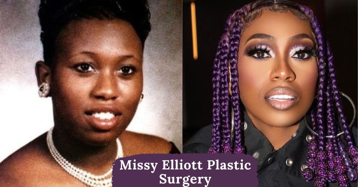 Missy Elliott Plastic Surgery