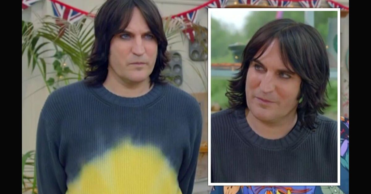 noel fielding illness