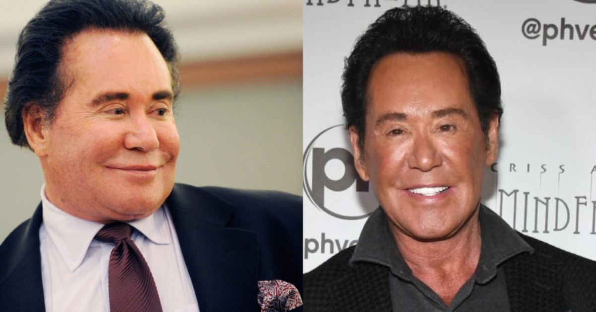 wayne newton plastic surgery